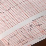 Immagine di un medico che esamina un paziente con un elettrocardiogramma per battiti cardiaci irregolari.